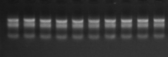 TRIzol LS Reagent提取RNA