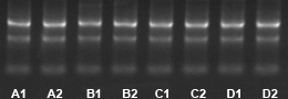 TRIzol ReagentȡRNA