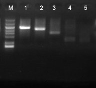 exonuclease III