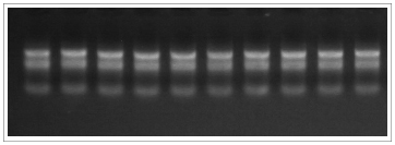 TRIzol LS Reagent提取RNA